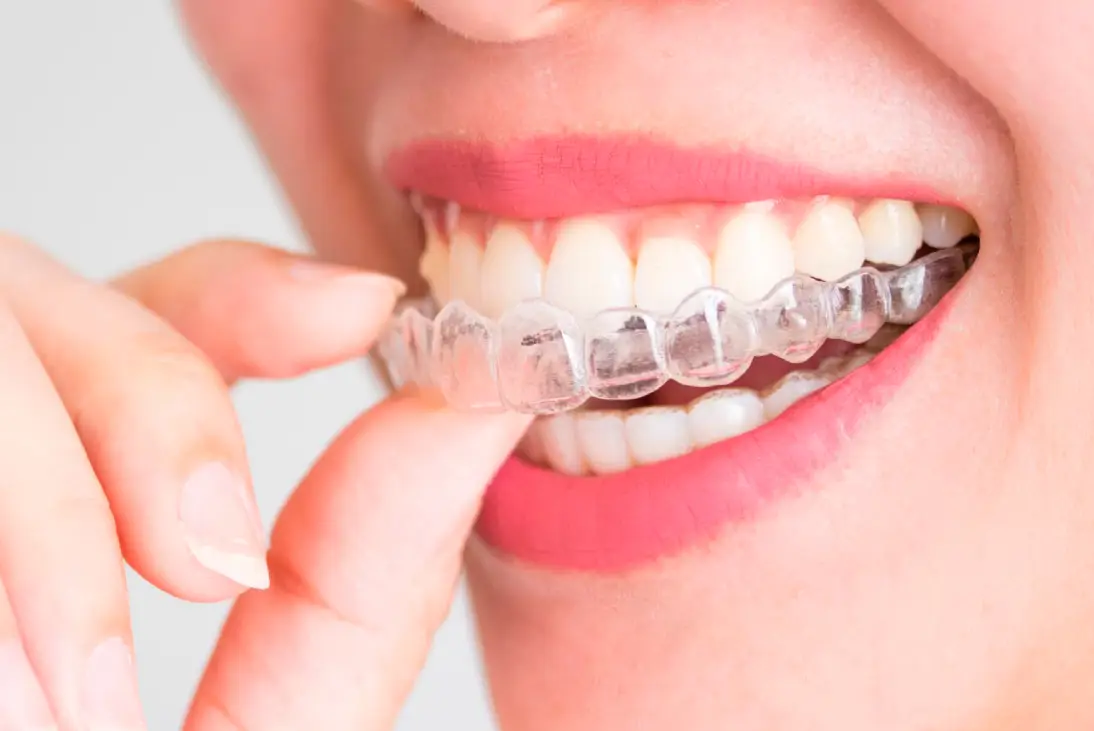 Dental instrument inserted in the mouth to do General Dentistry services