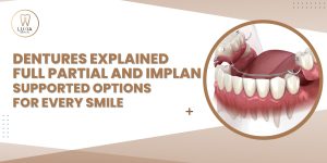 Dentures Explained Full Partial and Implant-Supported Options for Every Smile