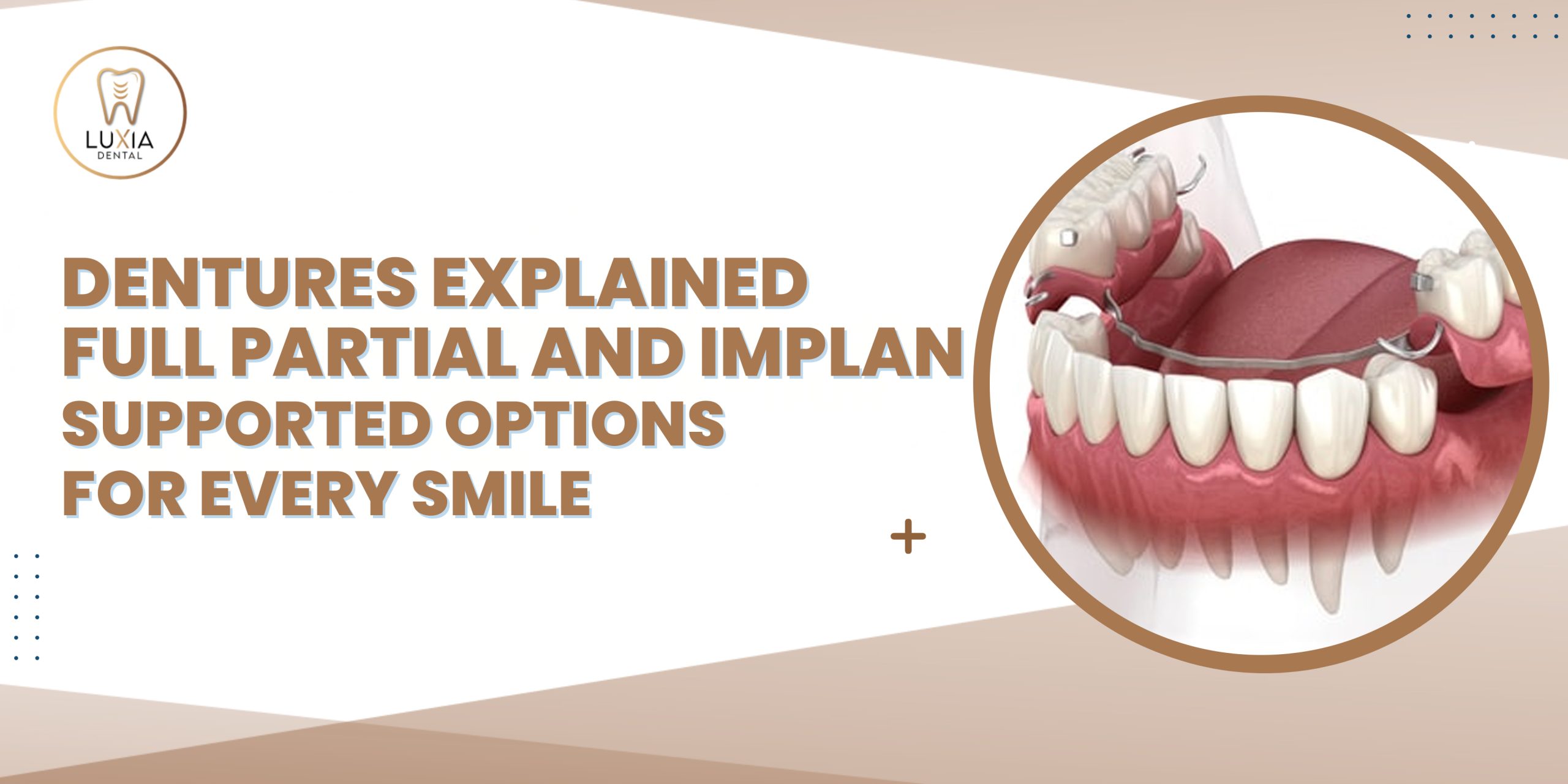 Dentures Explained Full Partial and Implant-Supported Options for Every Smile