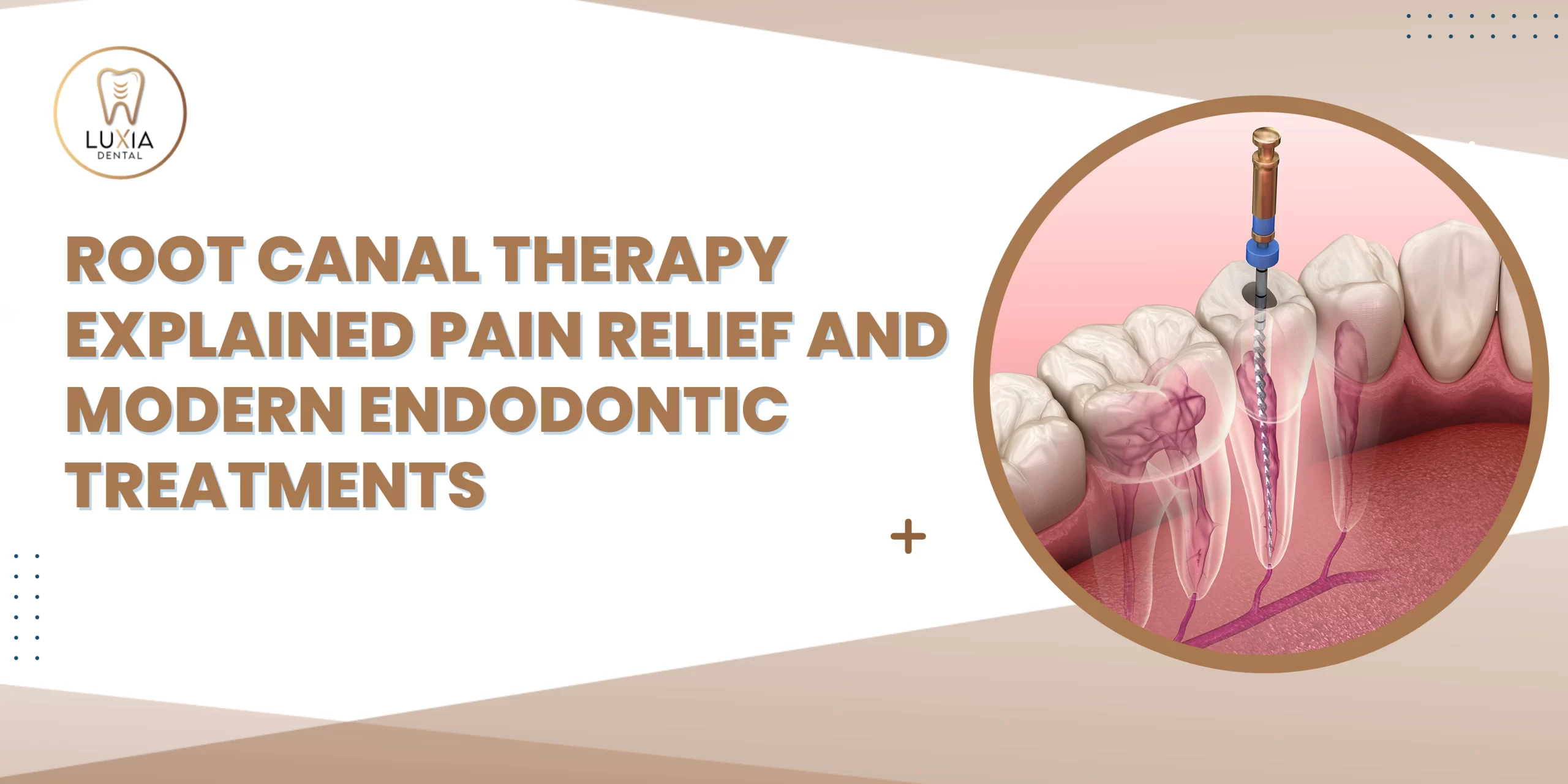 Root Canal Treatment Explained Pain Relief and Modern Endodontic Treatments