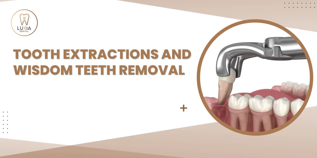 Tooth Extractions and Wisdom Teeth Removal What to Expect and How to Recover Faster