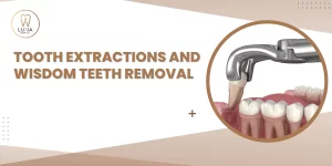 Tooth Extractions and Wisdom Teeth Removal What to Expect and How to Recover Faster