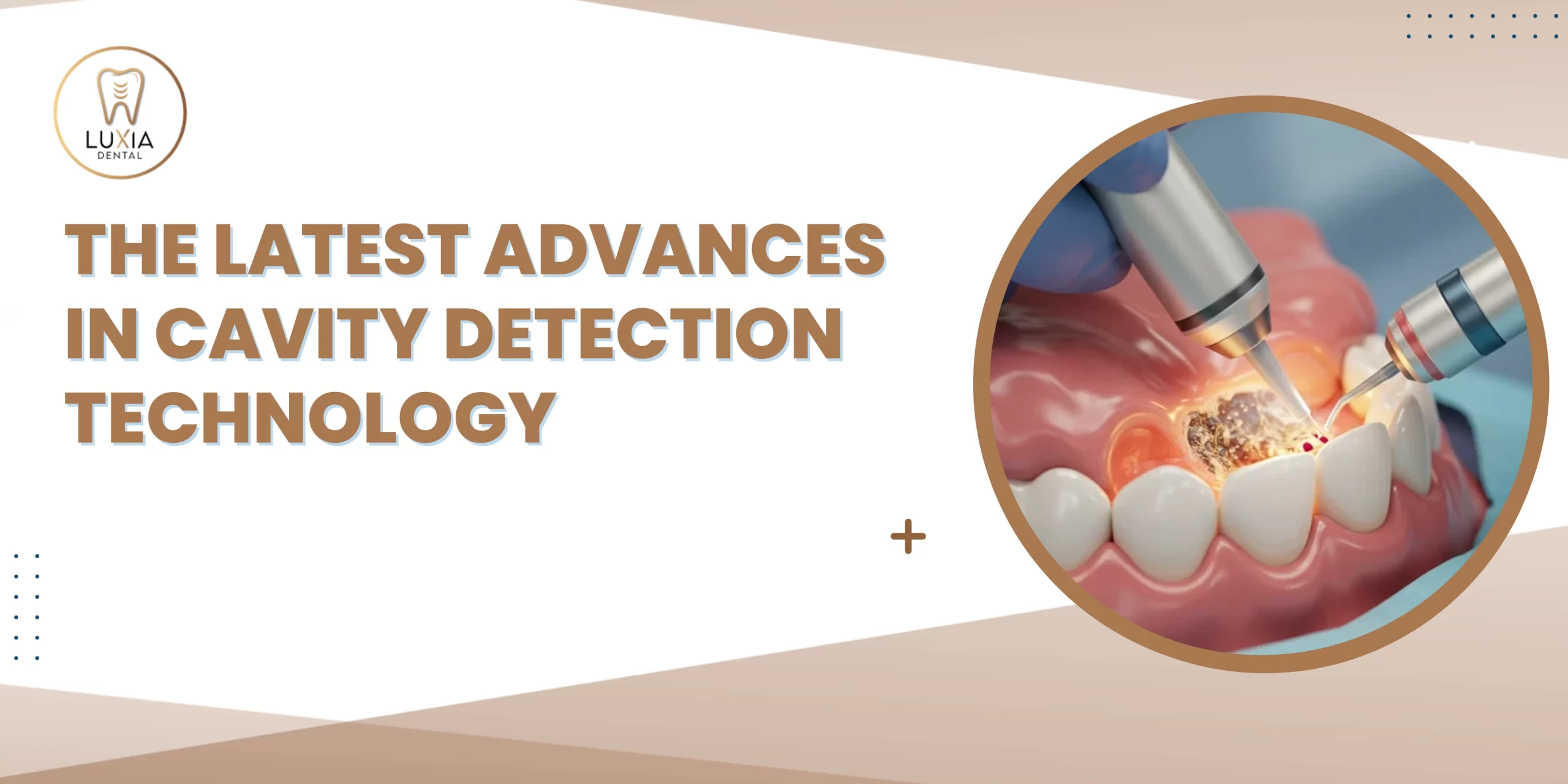 Cavity Detection Technology