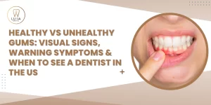Healthy vs Unhealthy Gums