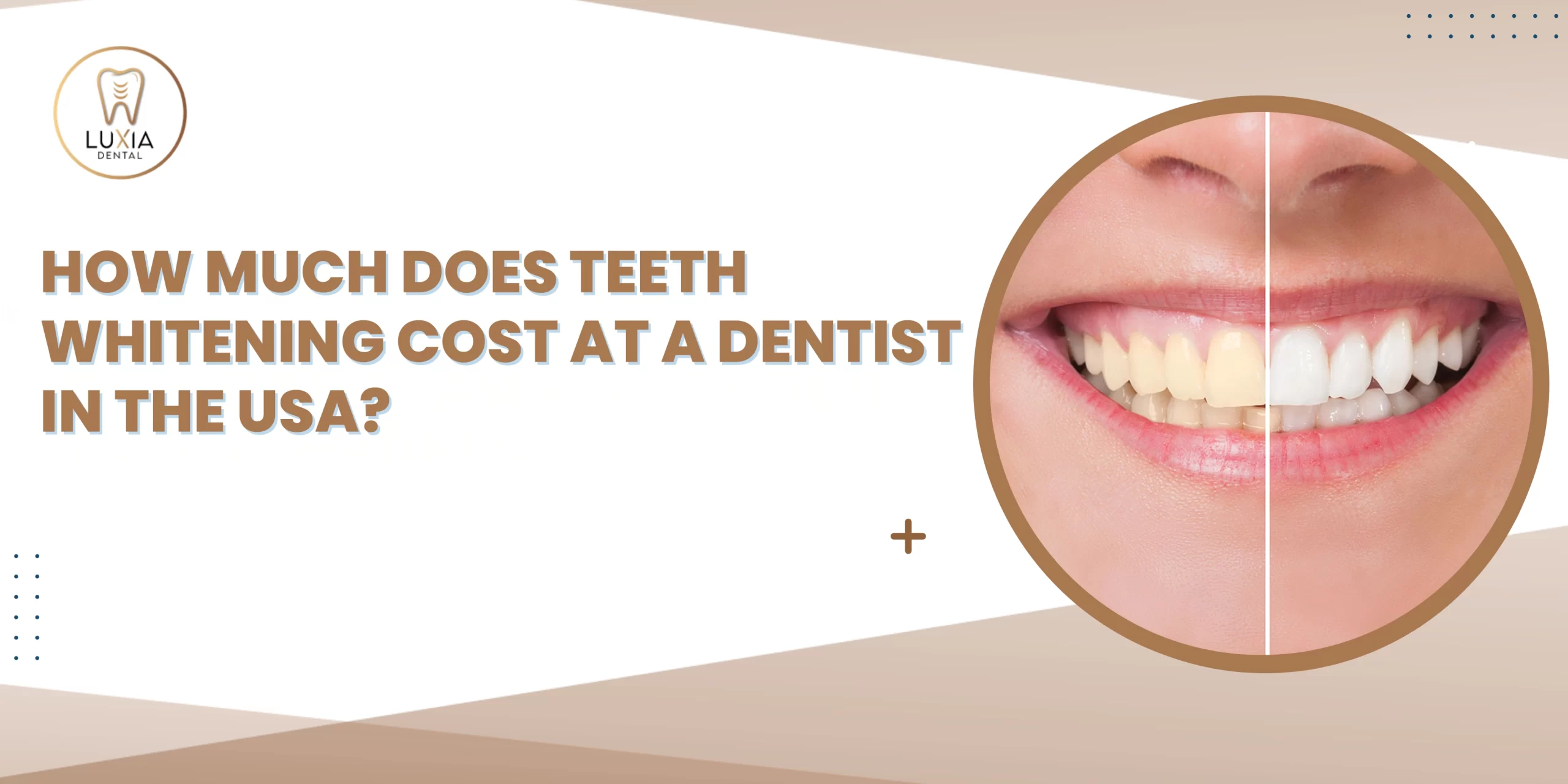 Teeth Whitening Cost at a Dentist in the USA