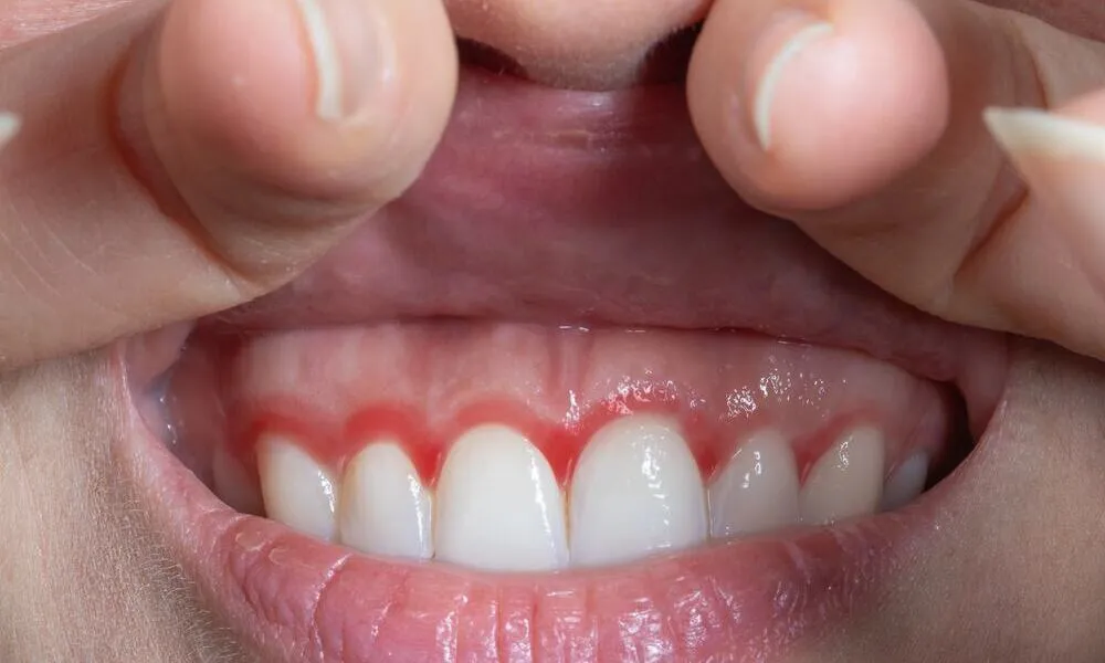 When to See a Dentist in the US