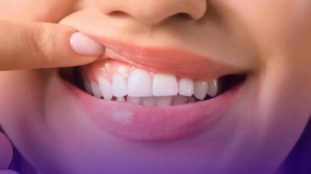 Why Does It Hurt So Much When Gums Recede?