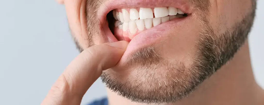 Healthy vs Unhealthy Gums