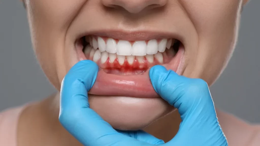 Treatment Options for Painful Receding Gums: One Tooth