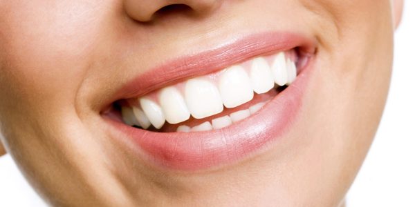 Teeth Whitening Cost at a Dentist in the USA